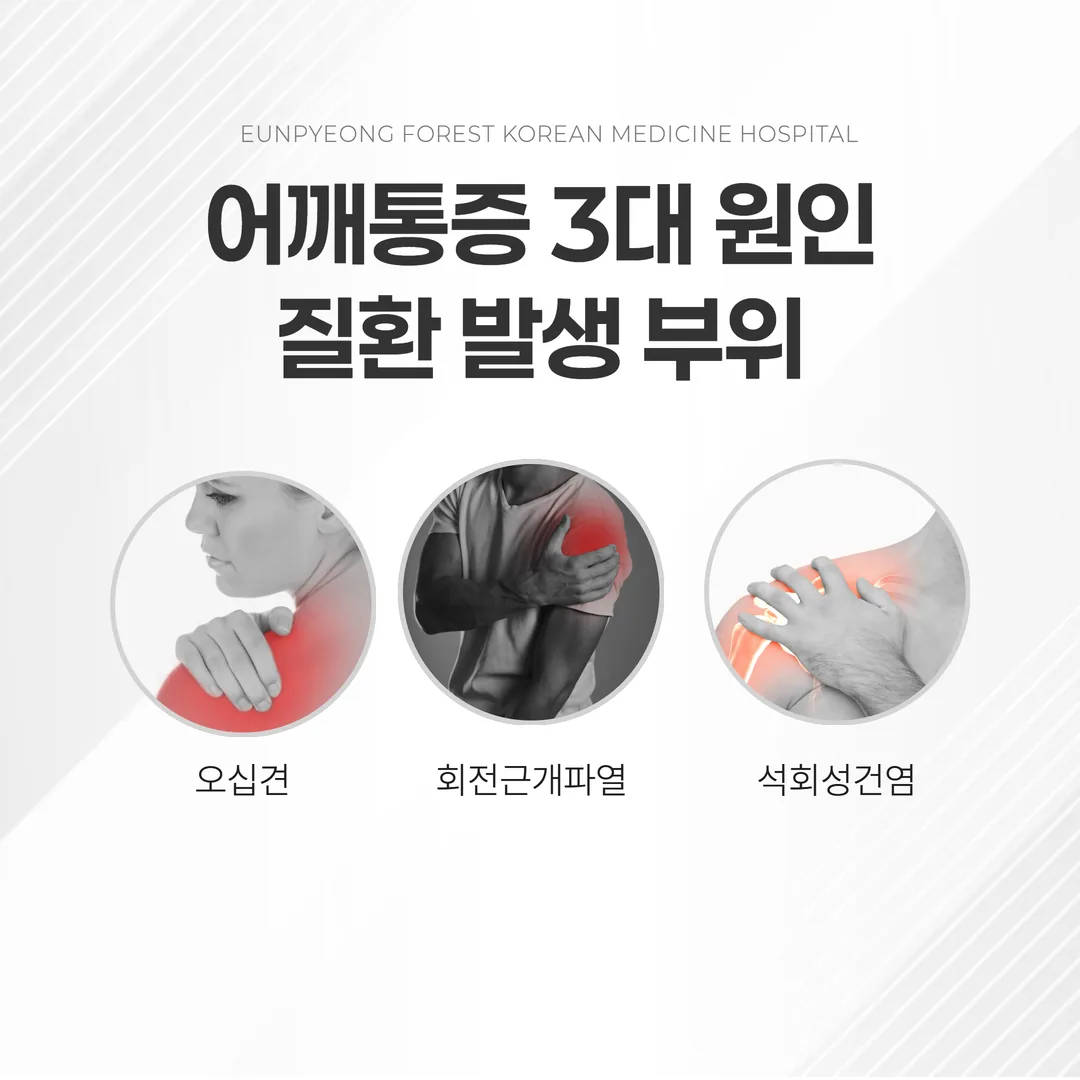 어깨통증 3대 원인 질환 발생 부위 일러스트