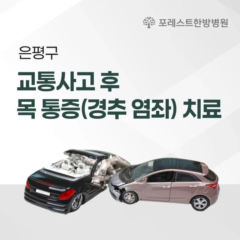 은평구 교통사고 후 목 통증(경추 염좌) 치료