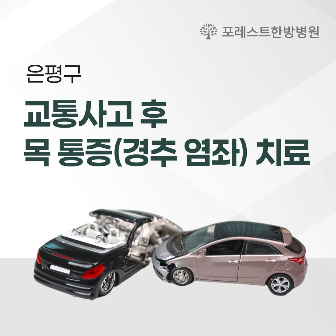 은평구 교통사고 후 목 통증(경추 염좌) 치료