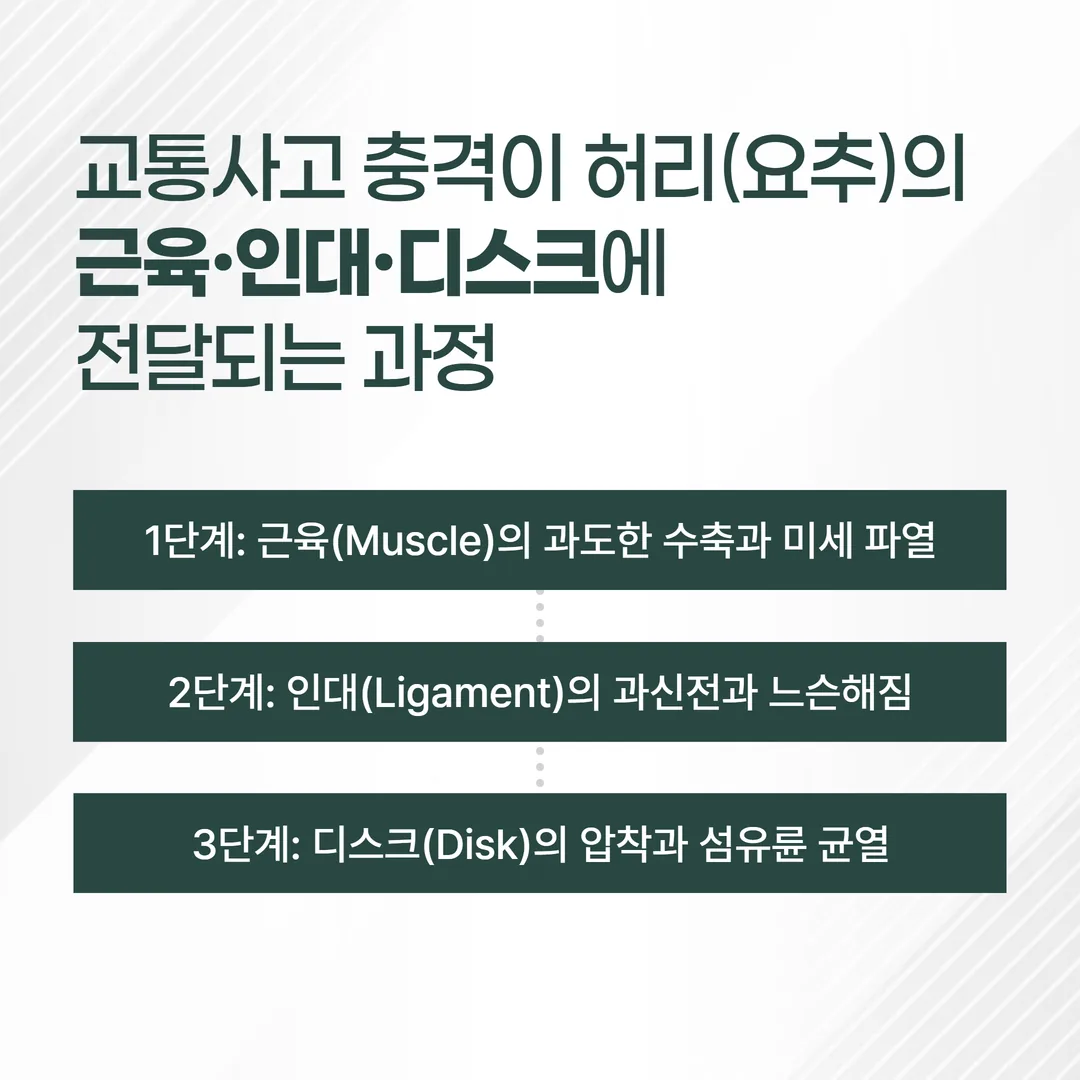 교통사고 후 허리 통증 요추 염좌 디스크 손상 원인