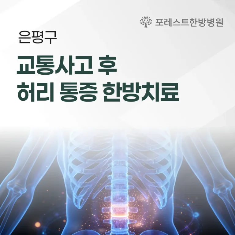 은평구 교통사고 후 허리 통증 한방치료
