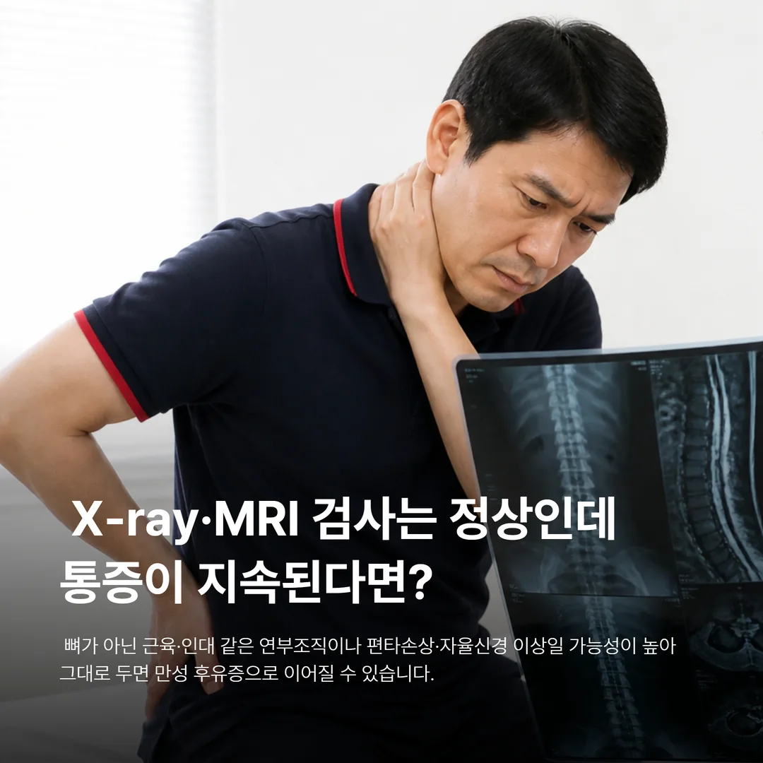 교통사고 후유증 검사 정상인데 통증 지속되는 환자
