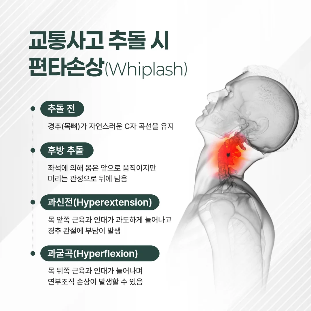 교통사고 편타손상 whiplash 경추 손상 메커니즘
