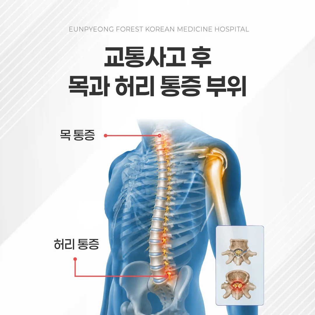 목디스크 허리디스크 등 추나요법 적응증이 되는 척추 관절 질환