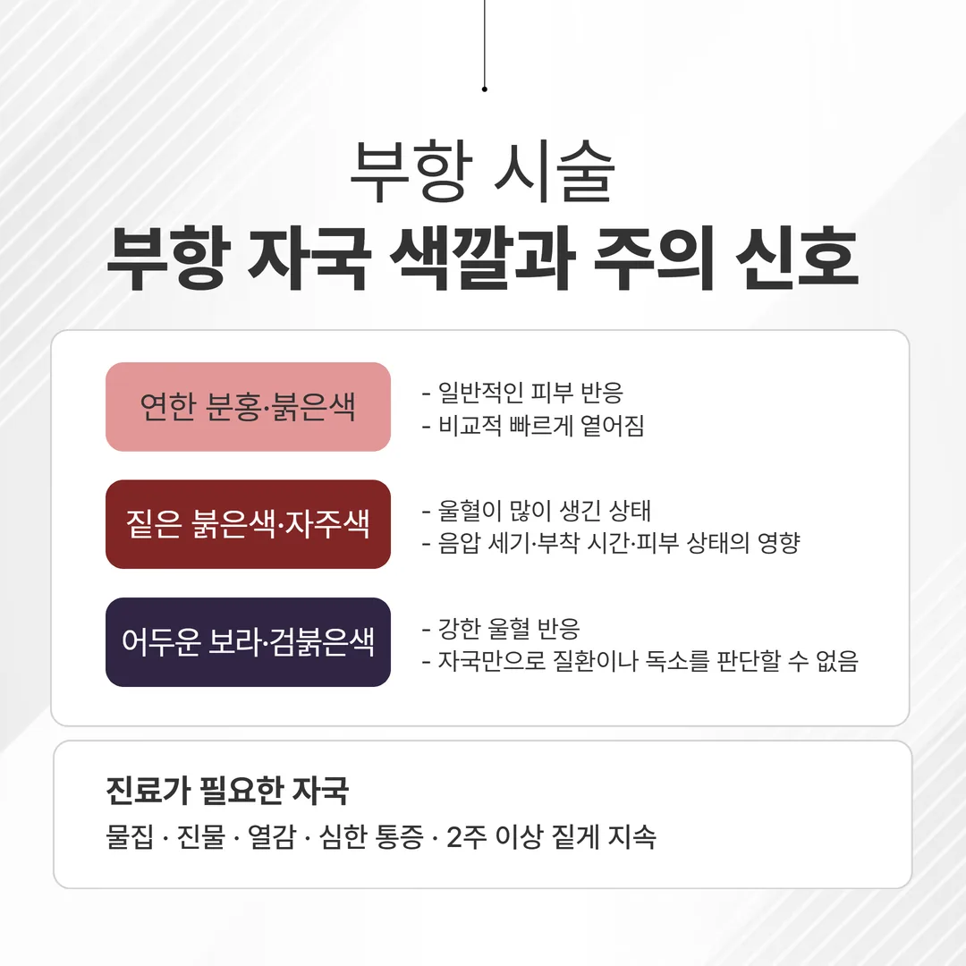부항 시술 시간·주기·자국 회복 기간 결정 가이드 인포그래픽