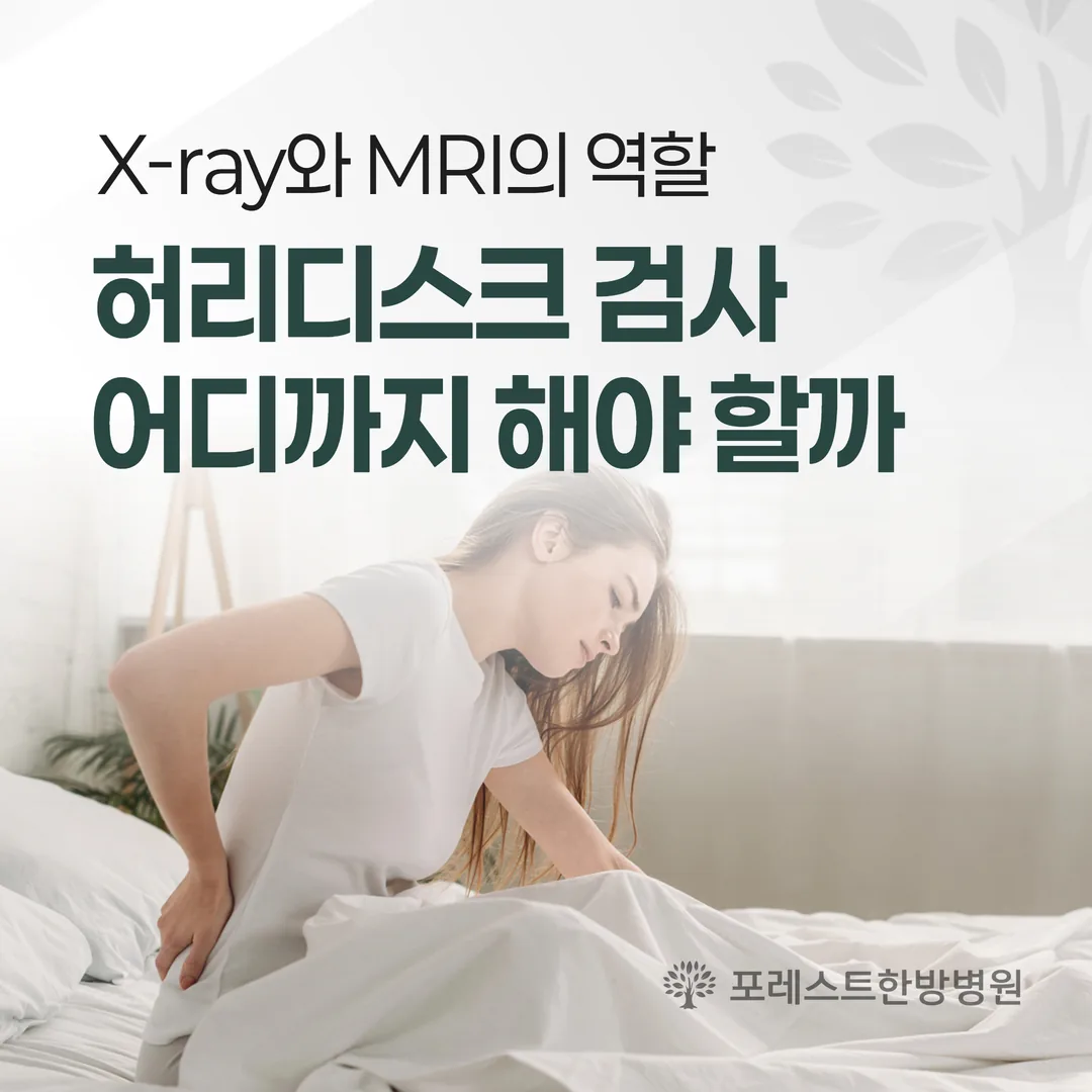 허리디스크 검사, 어디까지 해야 할까 — X-ray와 MRI의 역할