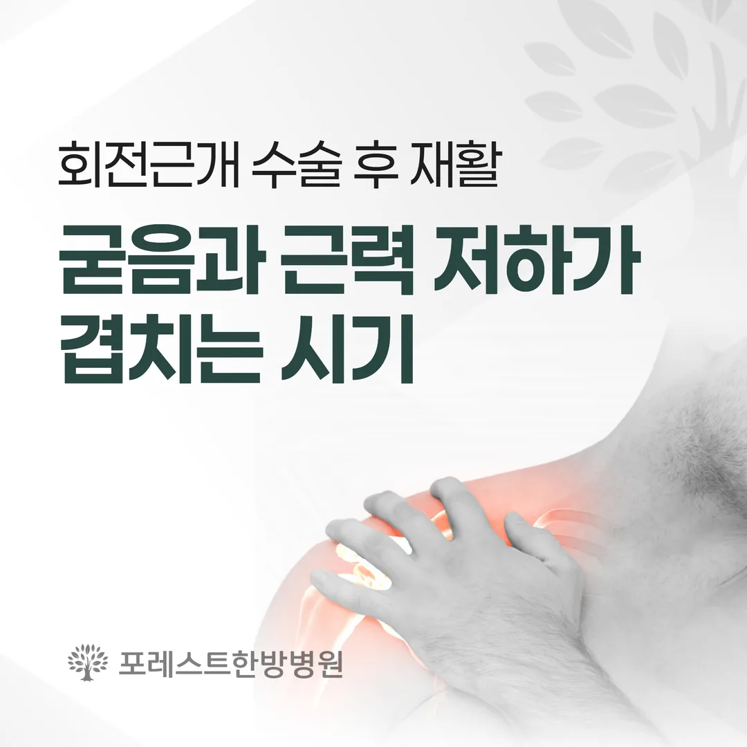 회전근개 수술 후 재활, 굳음과 근력 저하가 겹치는 시기