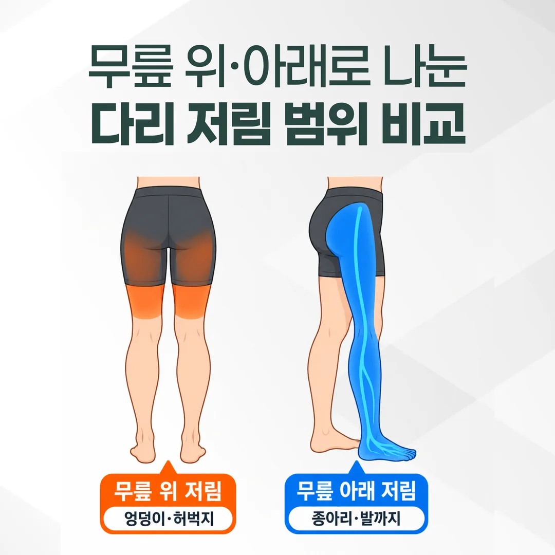 무릎 위와 무릎 아래로 나눈 다리 저림 범위 지도