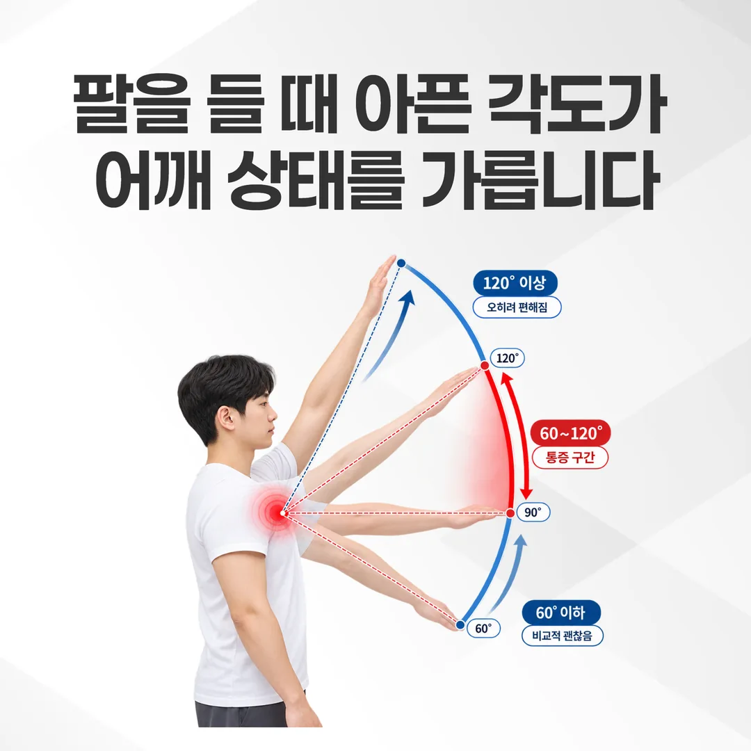 교통사고 후 어깨 통증에서 팔을 드는 각도별로 확인할 지점을 표시한 자가 확인 도해