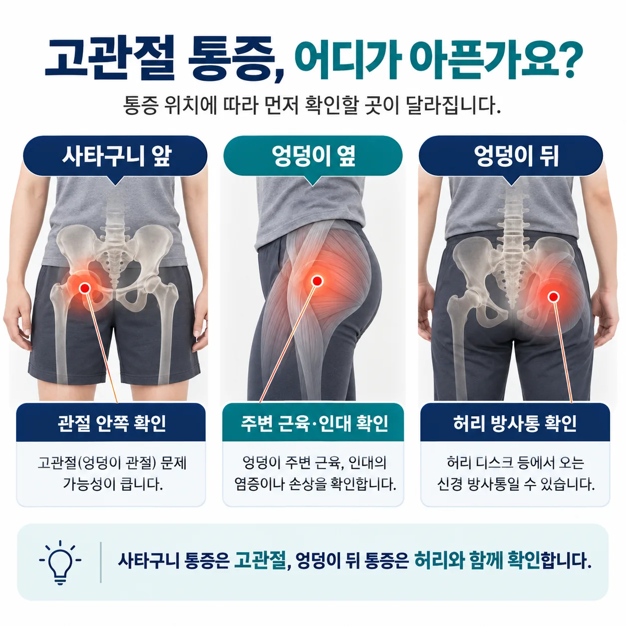 고관절의 위치와 통증이 나타나는 세 구역을 표시한 그림