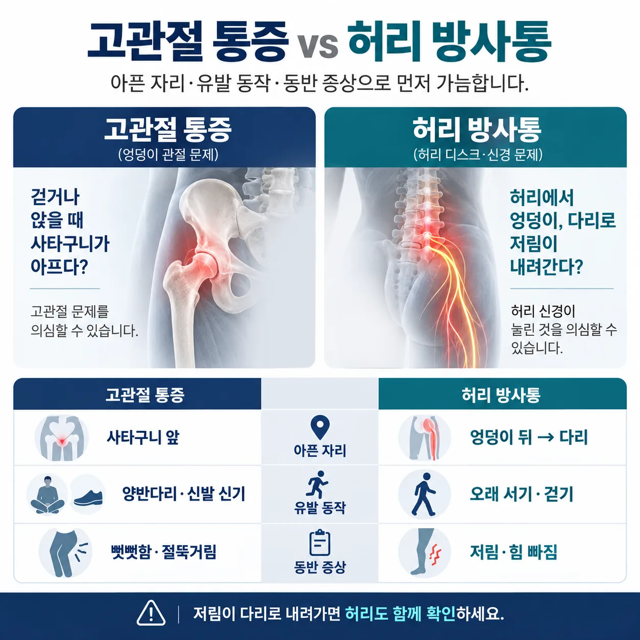 고관절 통증과 허리 방사통을 가르는 세 가지 기준 갈림 도표