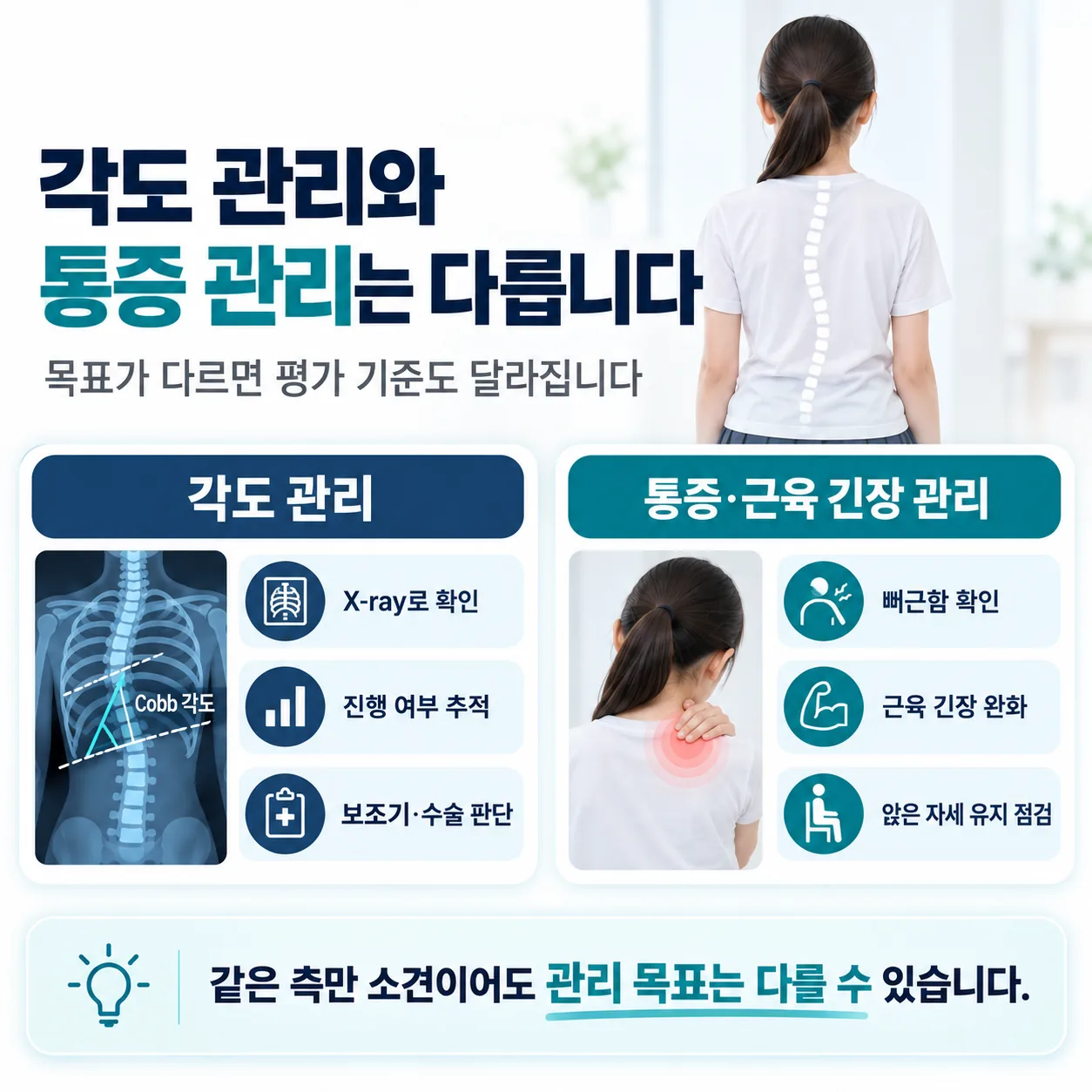 콥 각도 구간별로 관찰 보조기 수술 검토가 갈리는 기준을 나타낸 도식