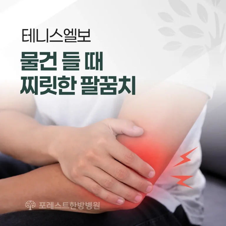 테니스엘보, 물건 들 때 찌릿한 팔꿈치 — 골프엘보와 구분·치료