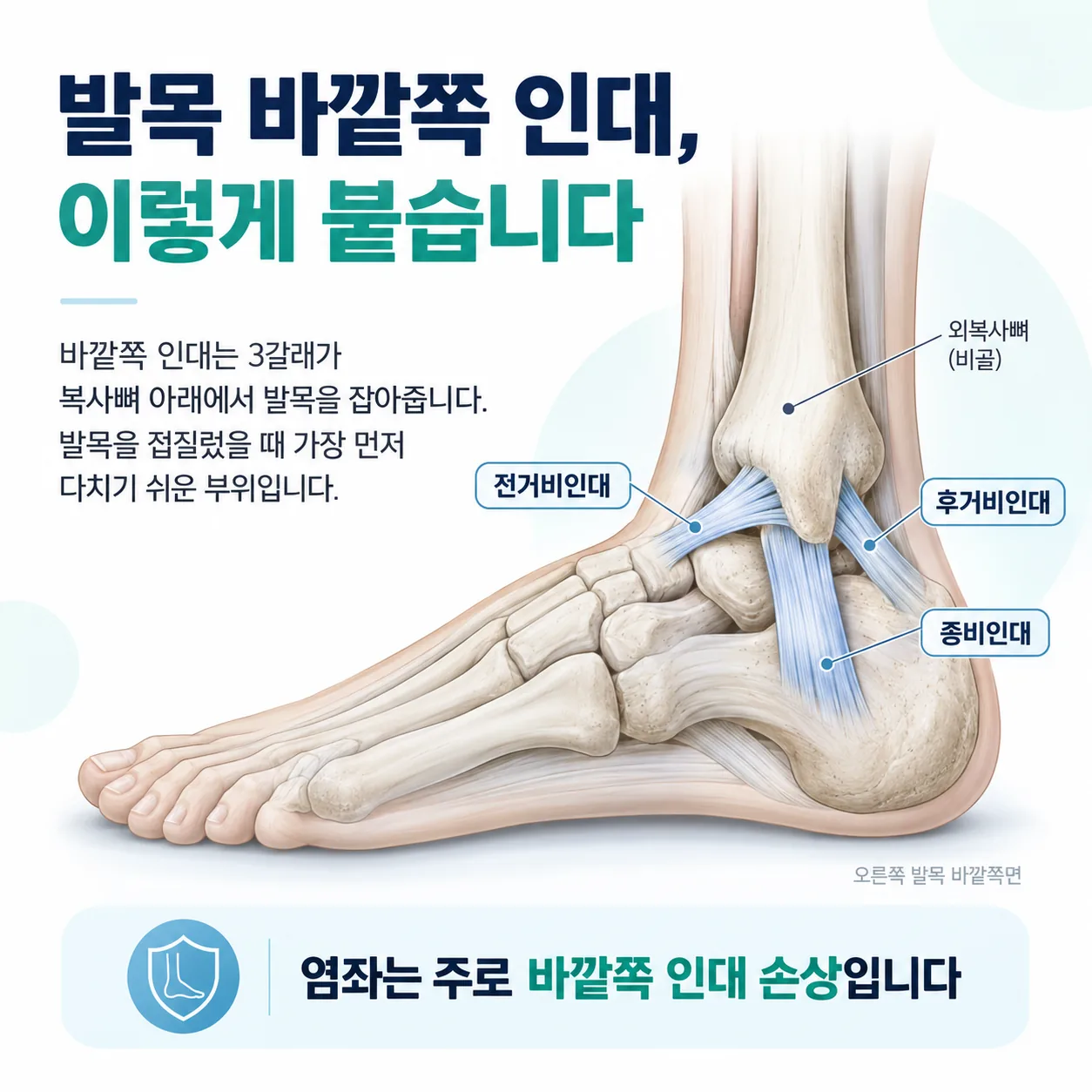 발목 바깥쪽 인대의 위치를 표시한 해부 도해