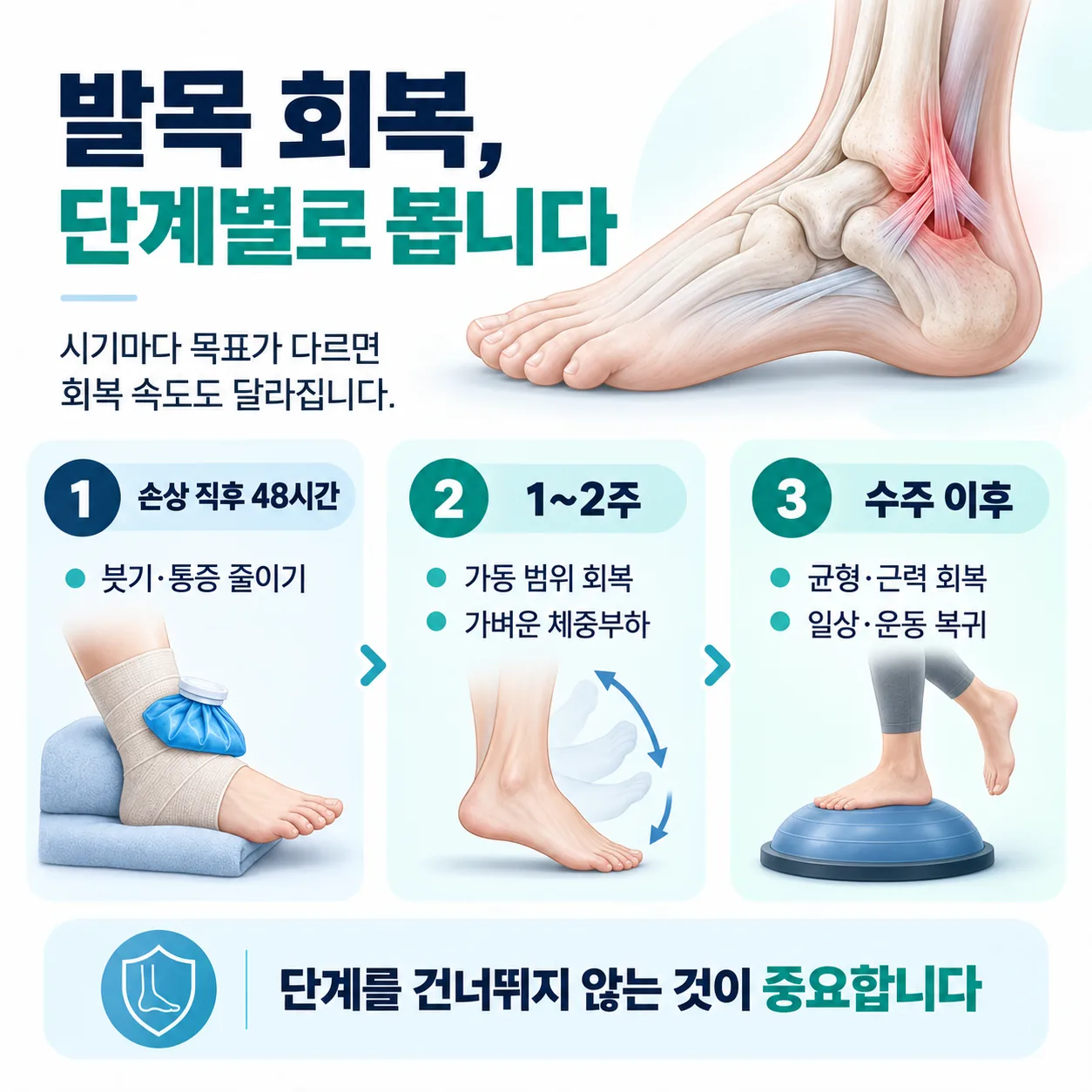 발목 염좌 회복 단계와 단계별 목표를 정리한 도표