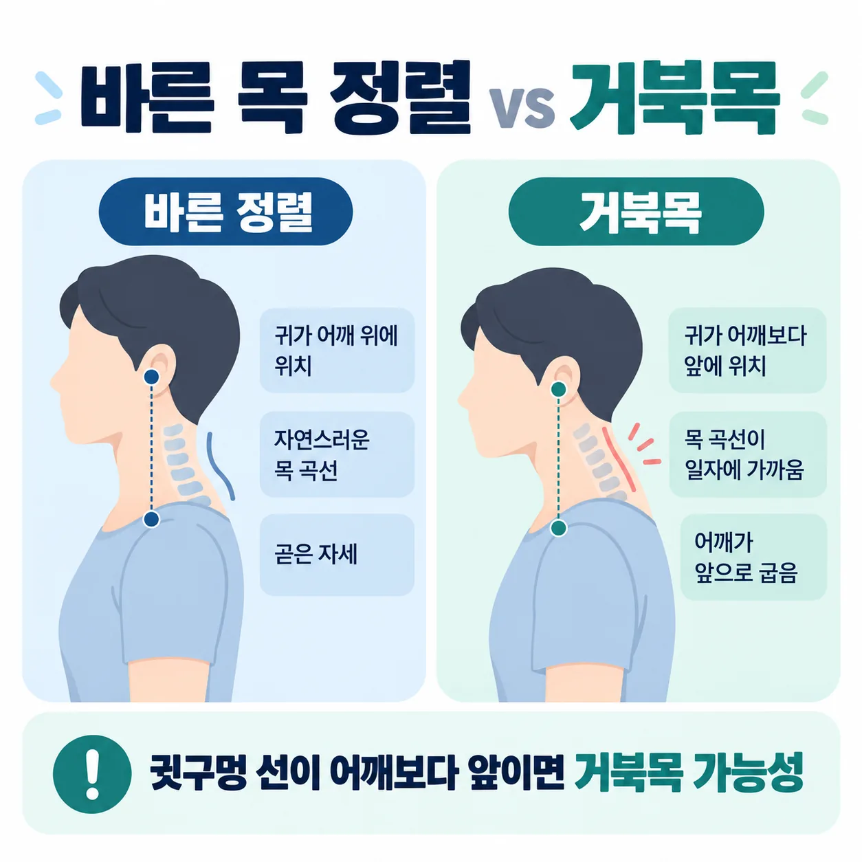 바른 목 정렬과 거북목 자세의 옆모습 비교