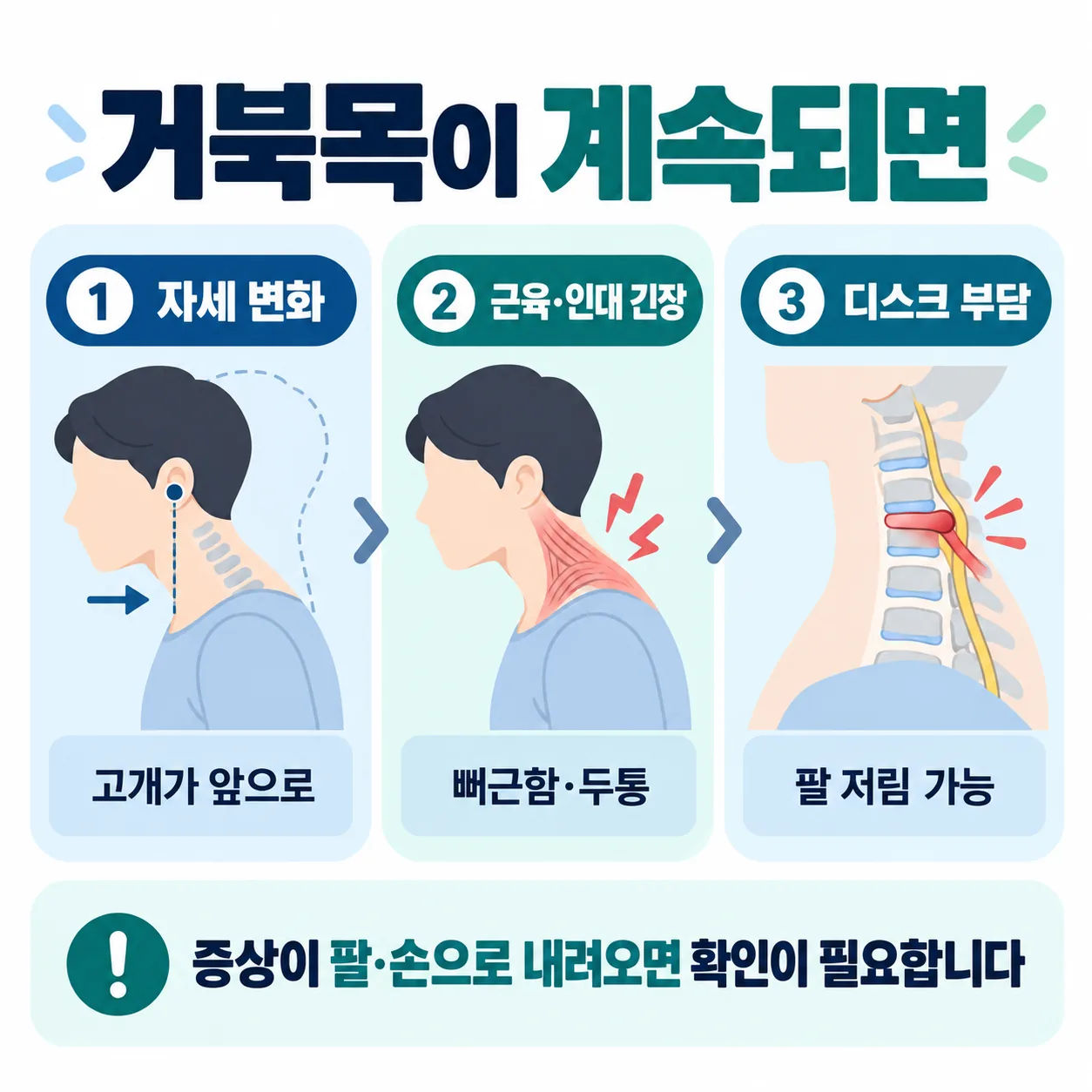 거북목에서 디스크 부담까지 이어지는 세 단계 관계도