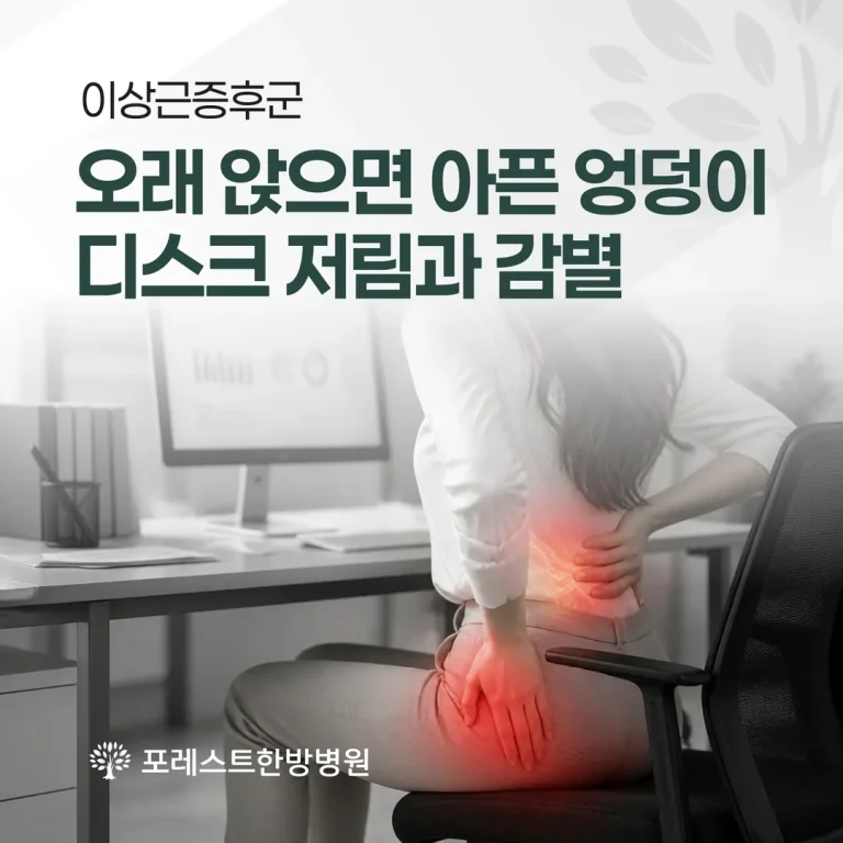 이상근증후군, 오래 앉으면 아픈 엉덩이 — 디스크 저림과 감별